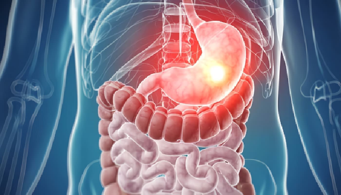 Gastroenterología Medicina