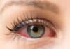 Ojos secos