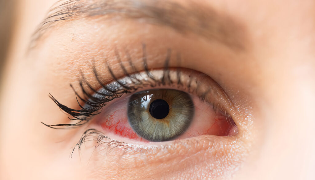Ojos secos