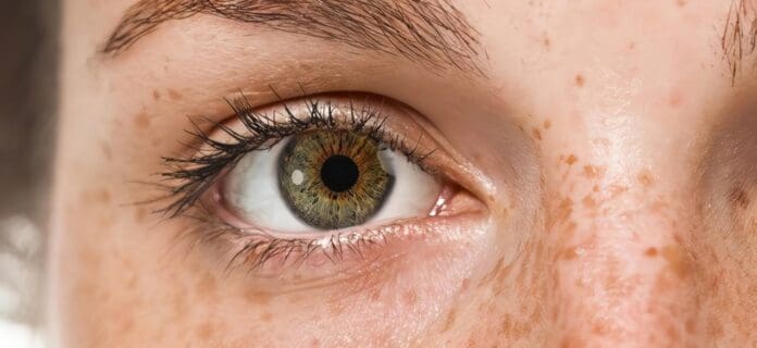 Microaguja Ocular