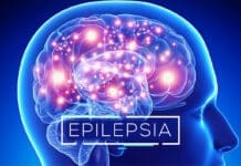 Qué es la Epilepsia