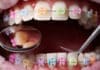 Ortodoncia los mejores tratamientos