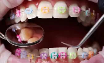 Ortodoncia tratamientos