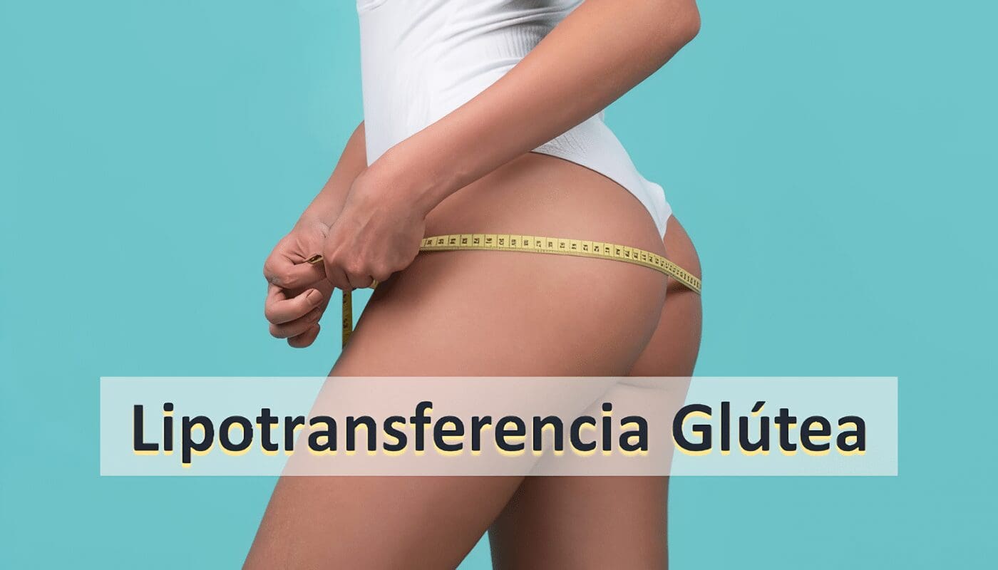 Lipotransferencia glútea