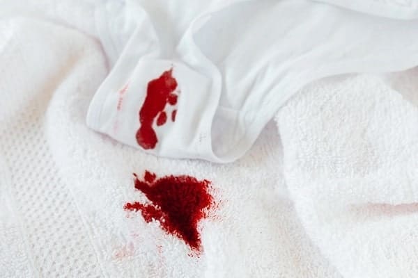 manchas díficiles sangre