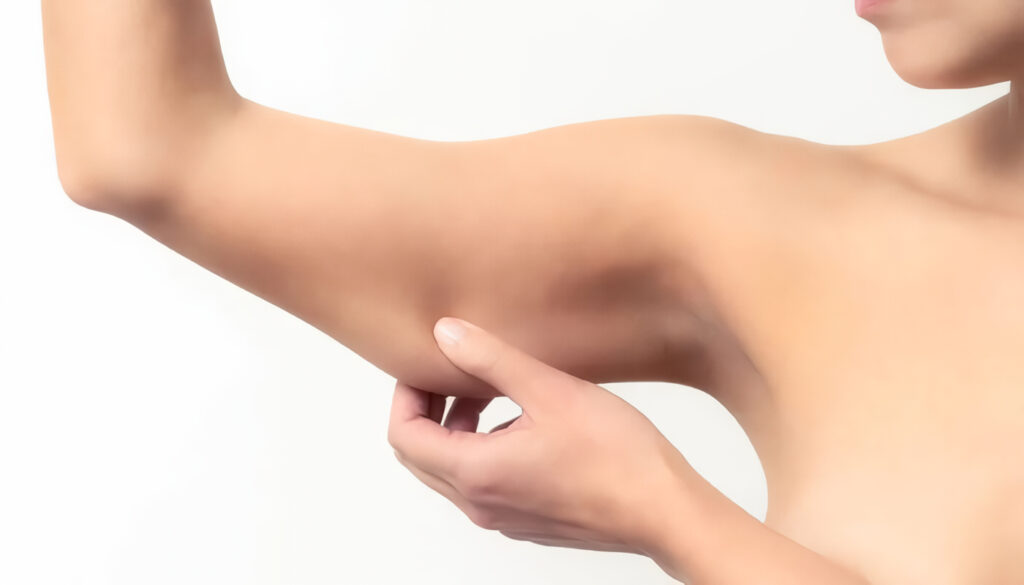 Braquioplastia