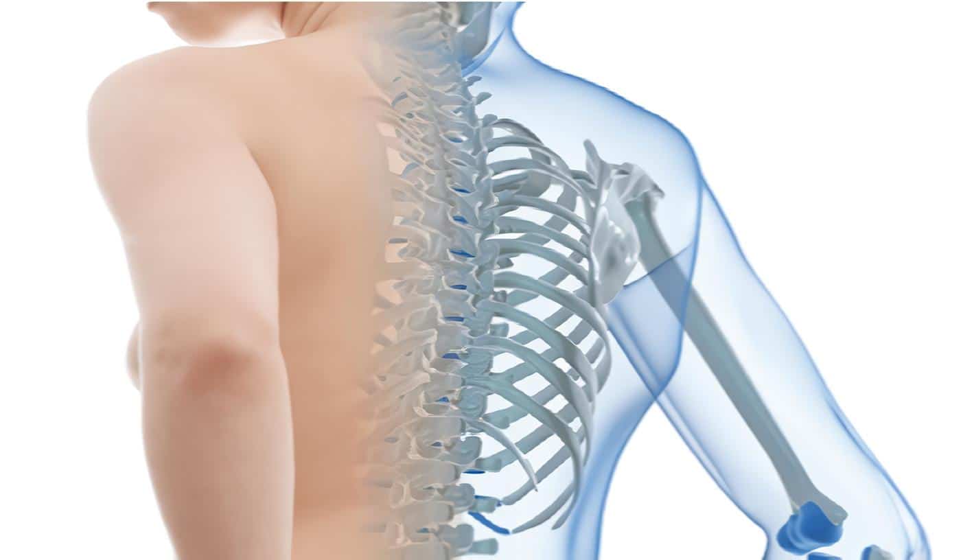 Osteoporosis Posmenopáusica y Estrógenos