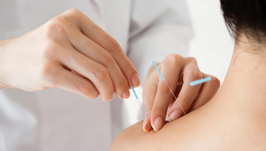 Los Diferentes Tipos de Acupuntura