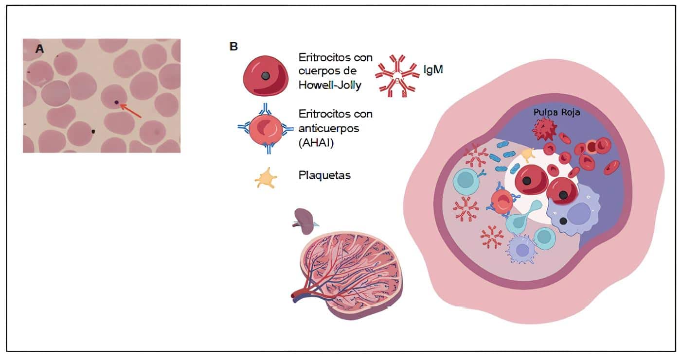 Funciones esplénicas y cambios post-esplenectomía