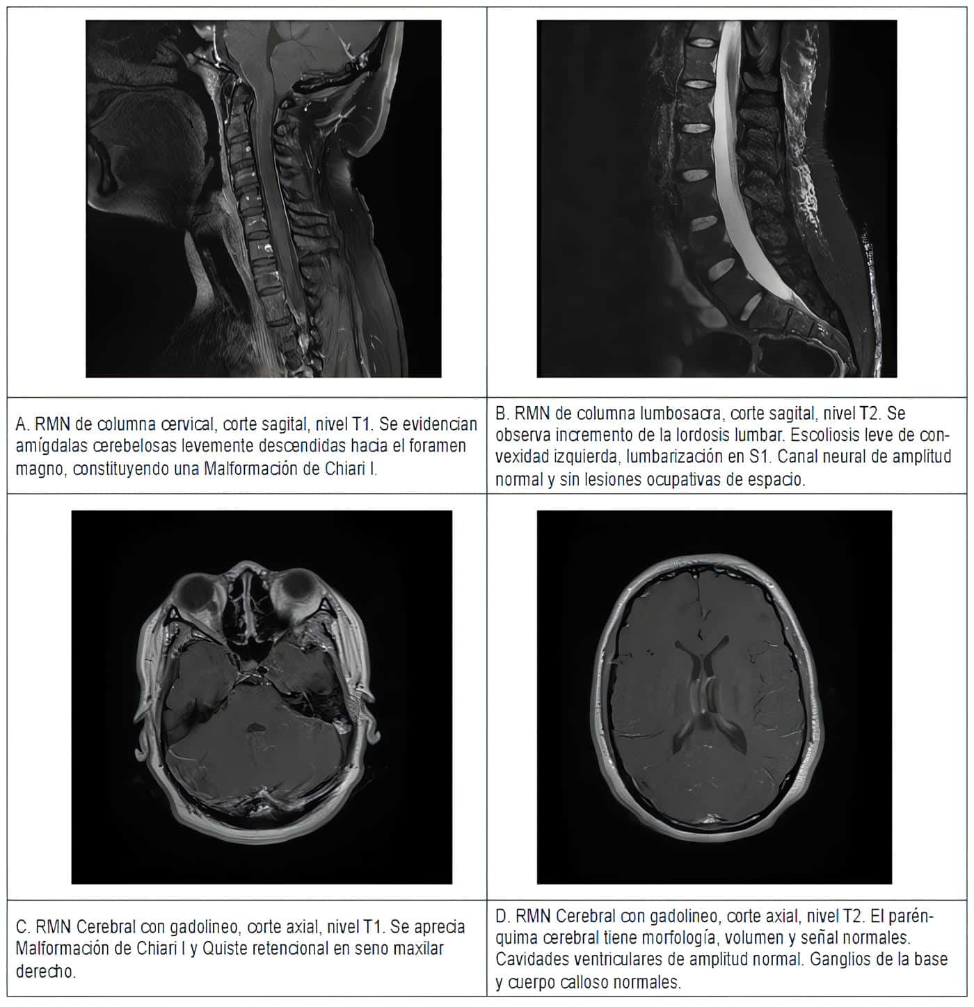Imágenes de resonancia magnética nuclear (RMN) del paciente