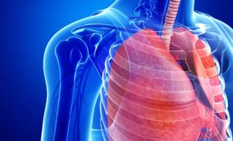 Prueba de subir escaleras como predictor de complicaciones cardiopulmonares