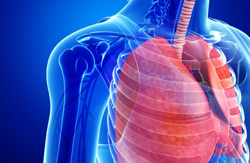 Prueba de subir escaleras como predictor de complicaciones cardiopulmonares