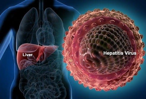 Hepatitis Autoinmune