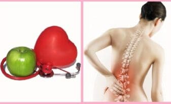 Osteoporosis y Enfermedad Cardiovascular en el Climaterio