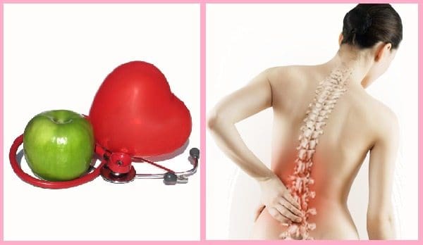 Osteoporosis y Enfermedad Cardiovascular en el Climaterio