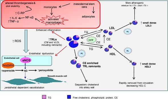 Lipemia Postprandial y Ateroesclerosis