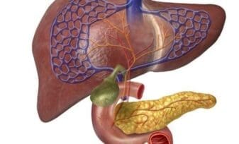 Tratamiento Endovascular del Síndrome de Budd-Chiari, a Propósito de un Caso