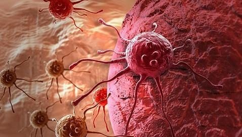 Células Tumorales circulantes podrían predecir los resultados del Cáncer de Próstata