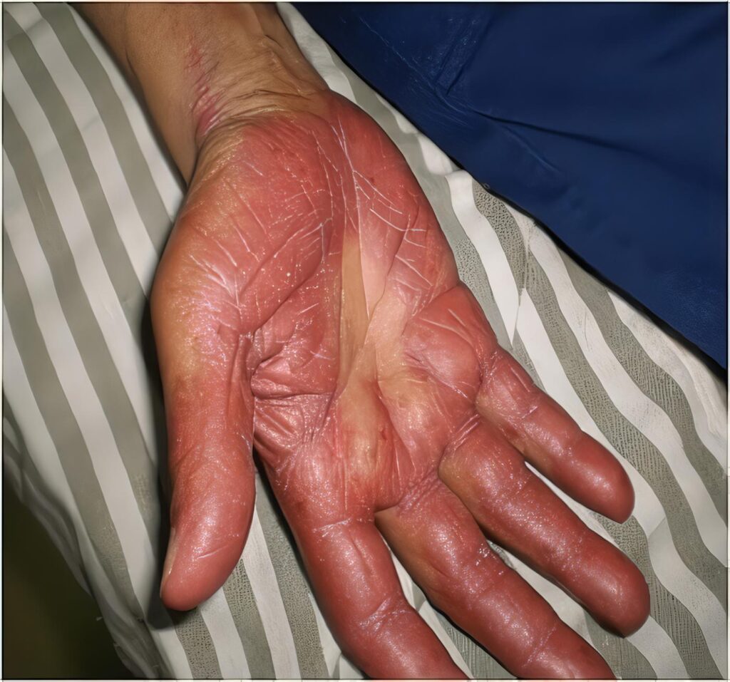 Estado del Arte en Psiquiatría y Psicoanálisis