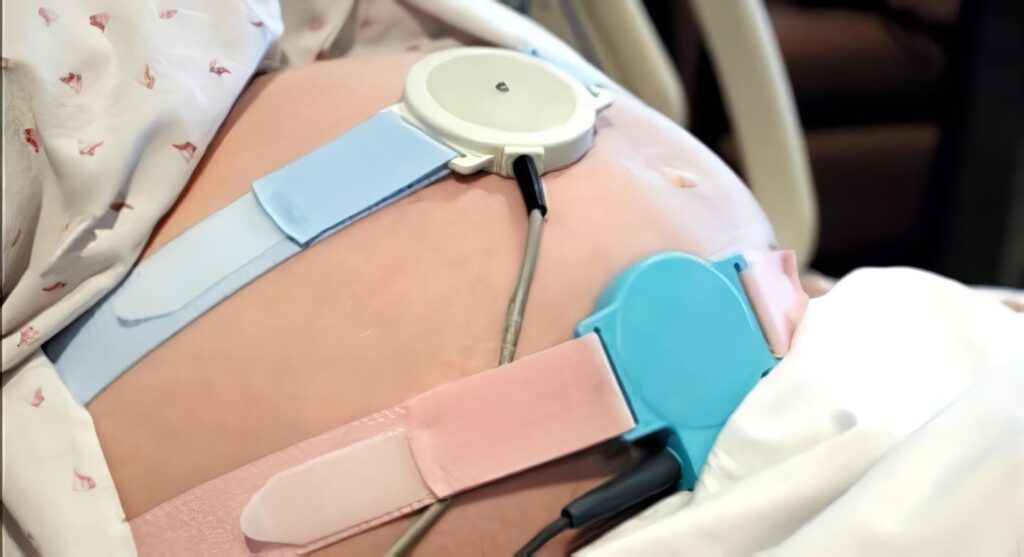 ¿Está recomendado El uso del Doppler en La Predicción de Preeclampsia en primer y segundo trimestre de La Gestación?