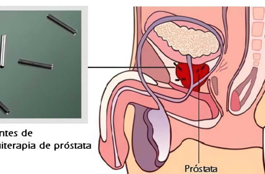 No hay Pruebas de que el Litio ayude en la ELA