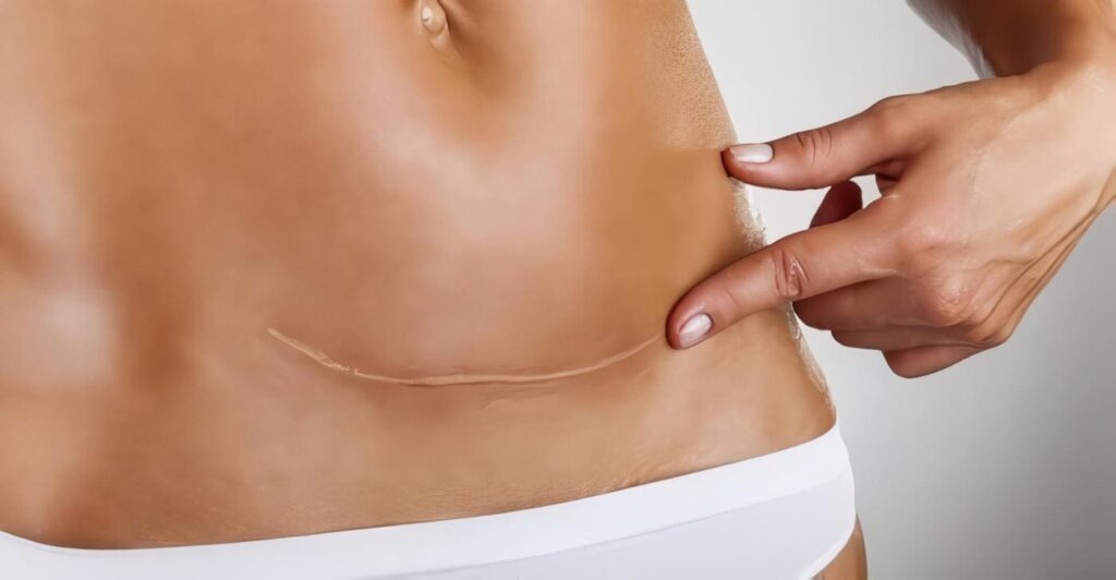 El Marketing en los Servicios Legales