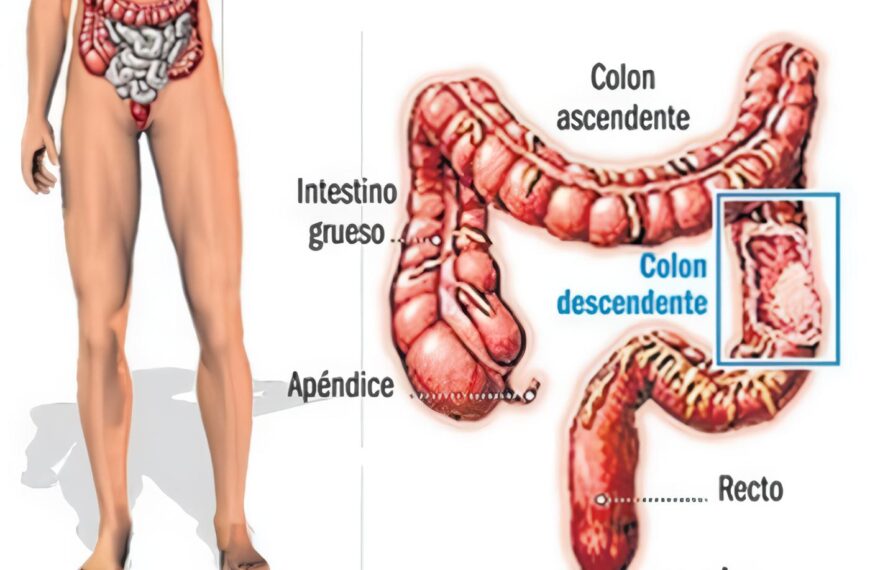 Medicamento contra el Colesterol podría Aliviar el Dolor de Espalda