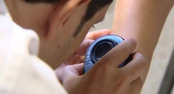 Medicamento Novedoso combate el Melanoma Avanzado