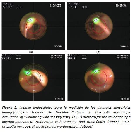 La Medición Clínica de los Umbrales sensoriales Laringofaríngeos y el Desarrollo del LPEER