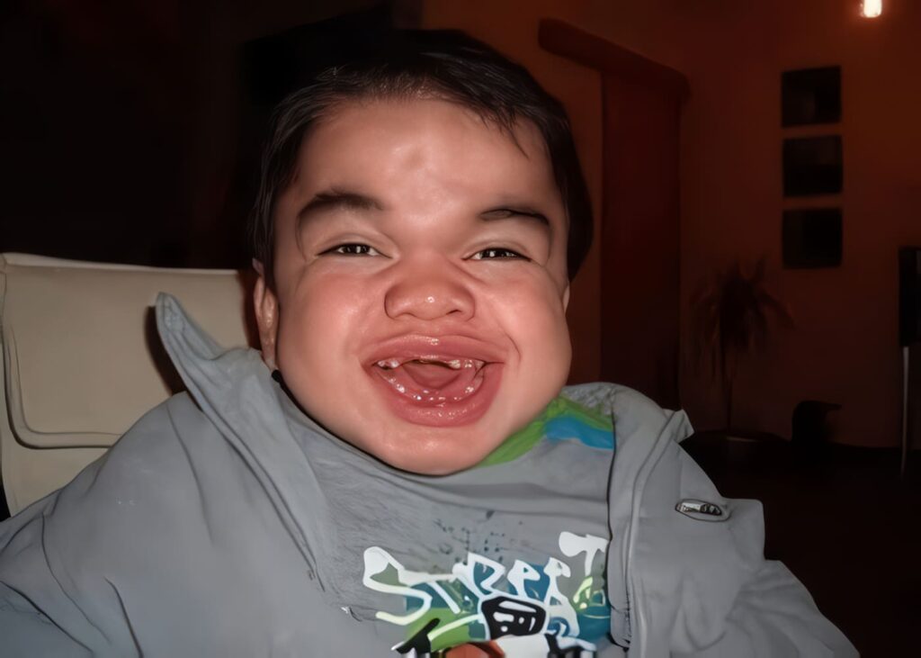 Leucemia Mieloide Crónica: Conclusión