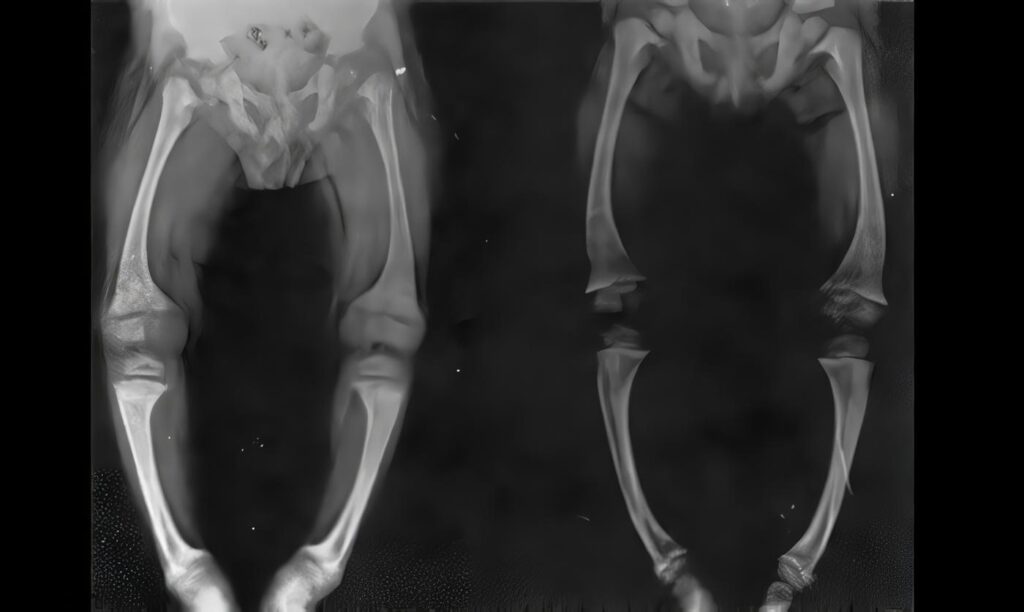 Reacciones al Látex