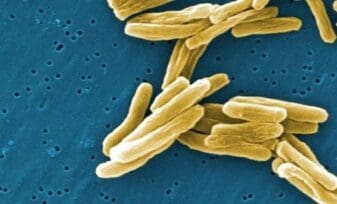 Tuberculosis Multirresistene