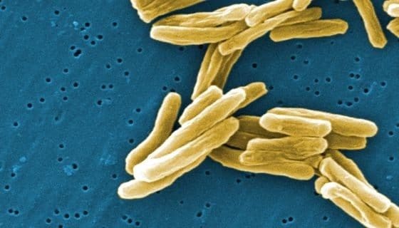 Tuberculosis Multirresistene