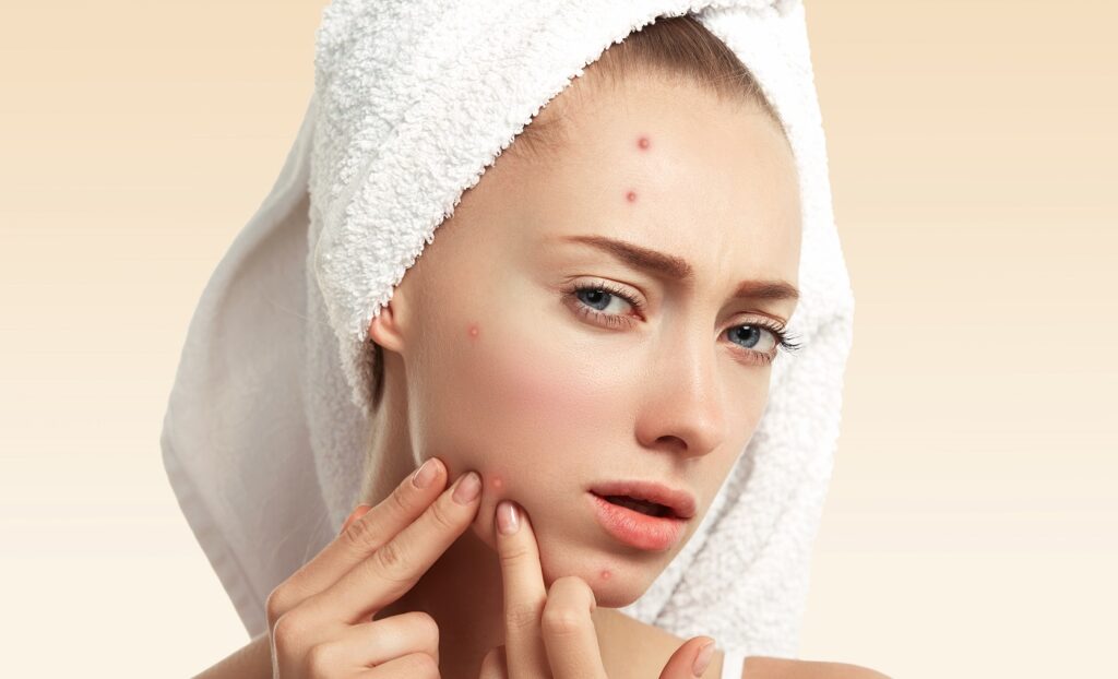 Colina, zinc y vitamina A: el trío del huevo que puede ayudarte contra el acné