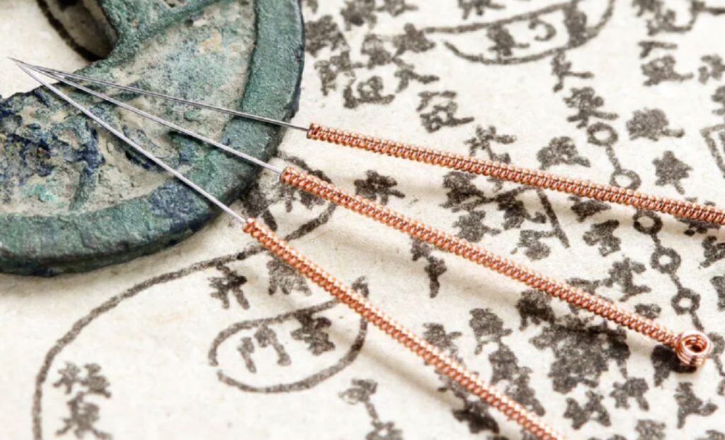 acupuntura japonesa que es